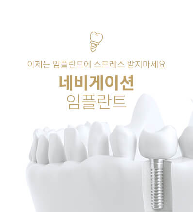 이제는 임플란트에 스트레스 받지마세요. 원데이 네비게이션 임플란트